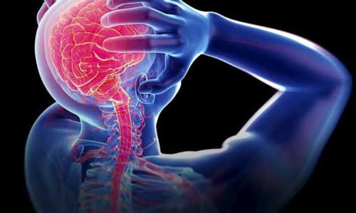 سلامتی سردرد